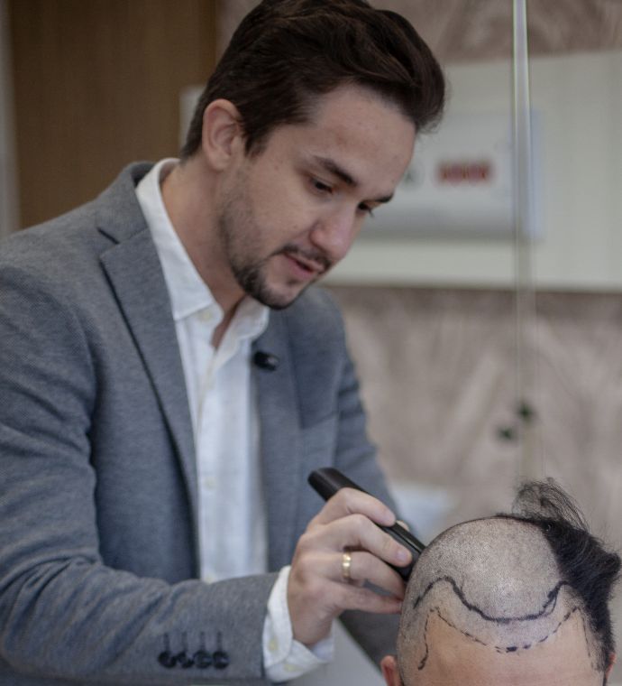 Dr. Tales Vieira realizando procedimento de transplante capilar FUE